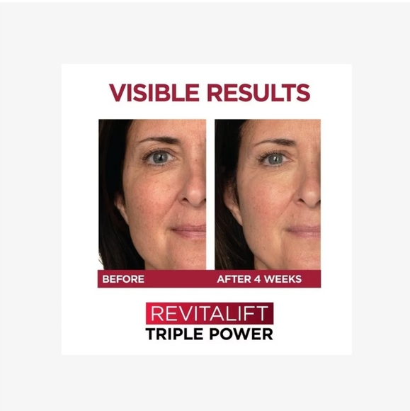 L'Oréal Revitalift C The Glow Kit - Picture 12 of 13